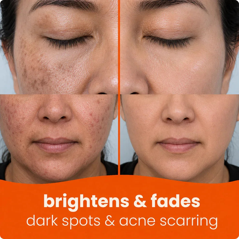 🔥Last Day 68% OFF-TopSpire Turmeric Kojic Glow Pads