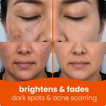 🔥Last Day 68% OFF-TopSpire Turmeric Kojic Glow Pads
