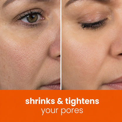 🔥Last Day 68% OFF-TopSpire Turmeric Kojic Glow Pads