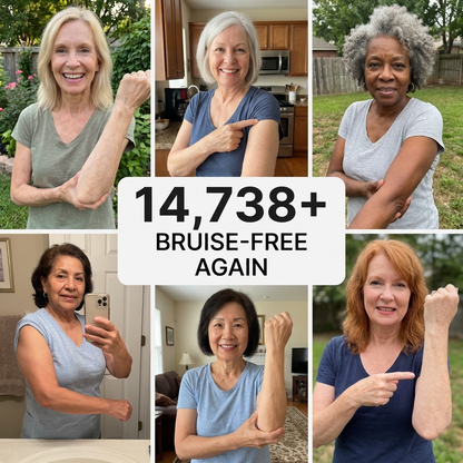 💥75K+ SOLD💕- Honorablejoy® Bruise Repair & Skin-Strengthening Cream